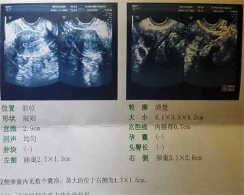 广州代生小孩价格,试管促排卵回家用药位置问题-子宫肌层回声欠均匀影响移植